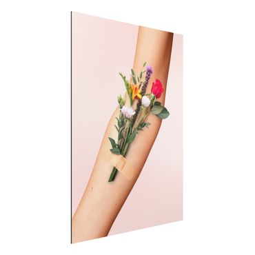 Impression sur aluminium - Arm With Flowers